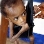 A Liberian boy suffering from severe malnutrition is weighed at the Action Contre La Faim (Action without Anger), theraputic feeding centre for the treatment of severe malnutrition, Monrovia 02 August 2003. The French aid organistation has been in Liberia since 1991 and says emergency food supplies are available here but the other moderate theraputic clinics have only 2 weeks worth of food. The World Food Programme food store has some 10 000 tons of food but is not accesible due to it being in rebel controlled teritory in Freeport, Monrovia.<br />